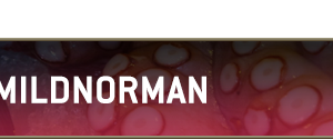 Tentacles_MIldNorman_Header